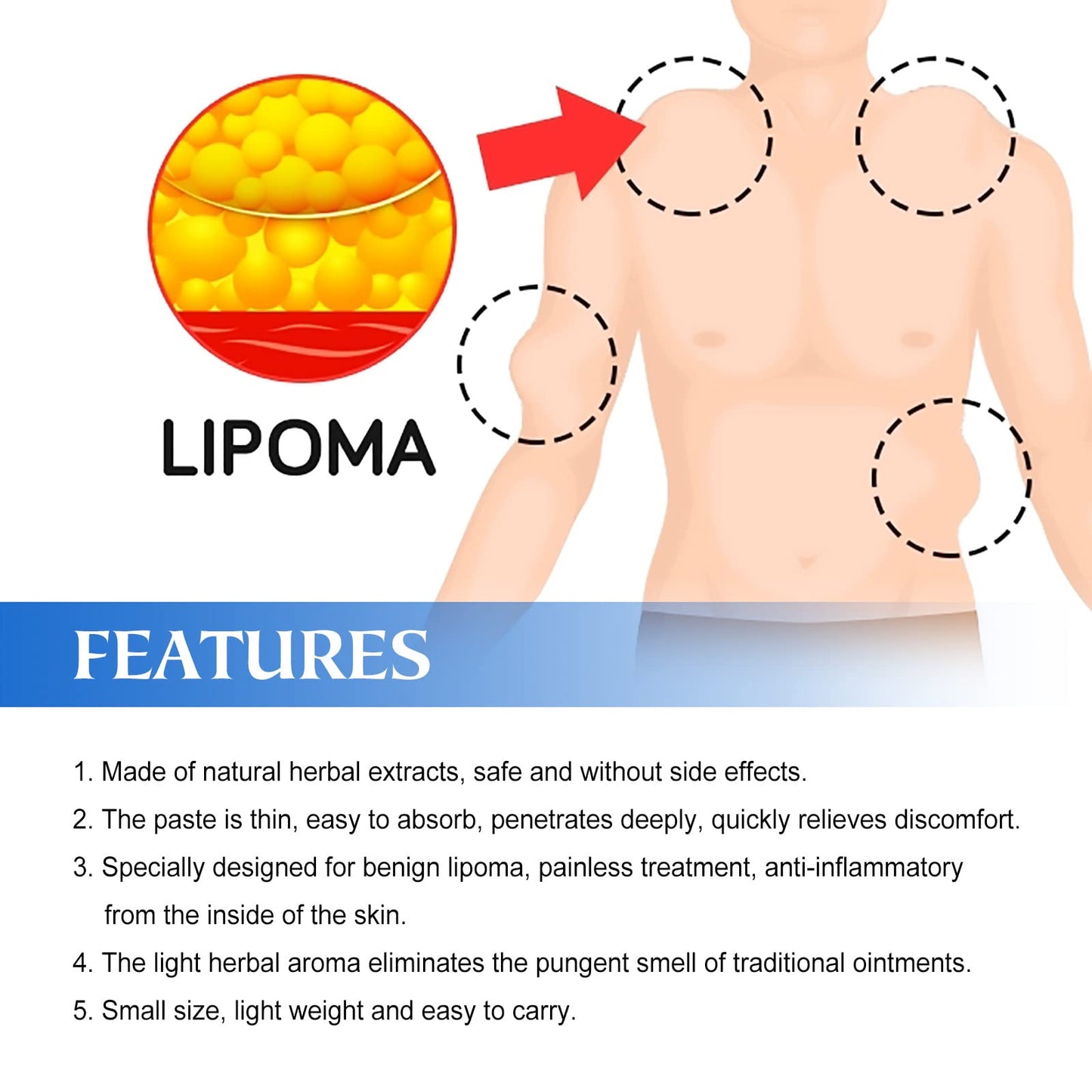Lipoma Removal Cream Plant Extract Tumors Treat Skin Swelling Ointment Relief