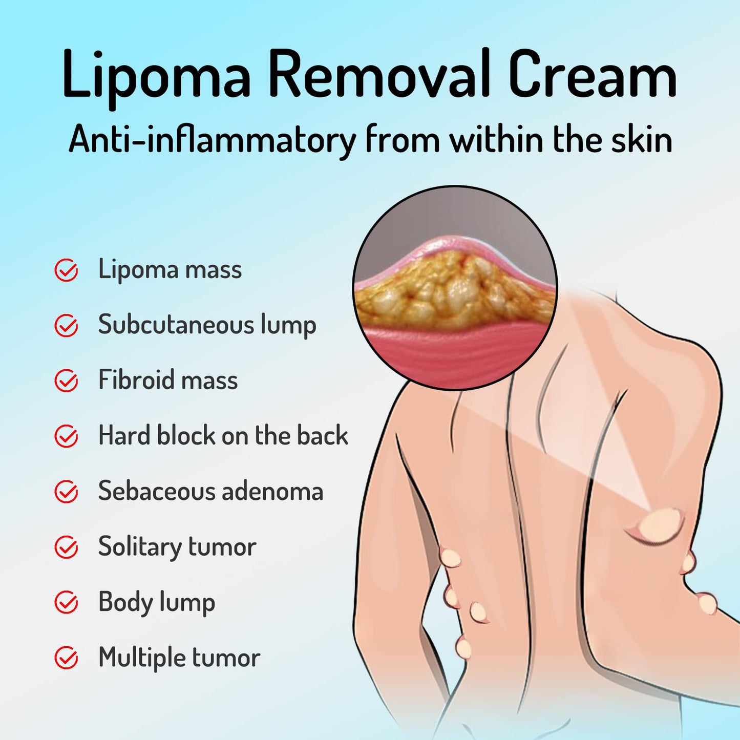 Lipoma Removal Cream Plant Extract Tumors Treat Skin Swelling Ointment Relief