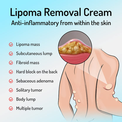 Lipoma Removal Cream Plant Extract Tumors Treat Skin Swelling Ointment Relief