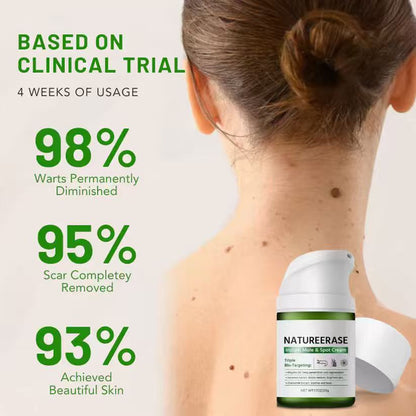 Instant Mole & Spot Cream Erase Unwanted Marks in 7 Days Without Surgery, Pain, or $650 Doctor Bills