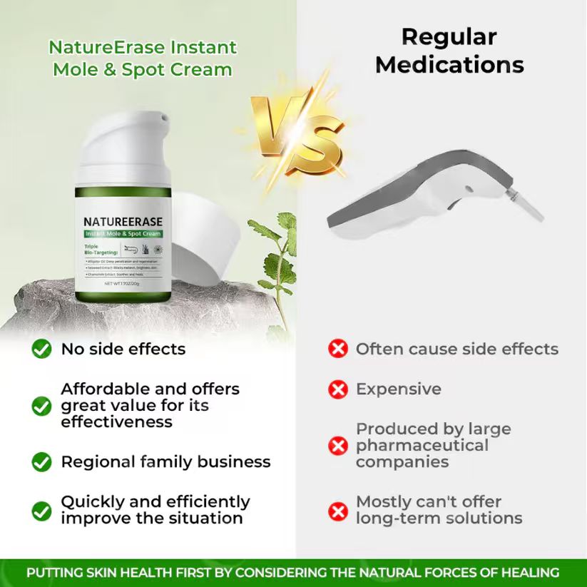 Instant Mole & Spot Cream Erase Unwanted Marks in 7 Days Without Surgery, Pain, or $650 Doctor Bills